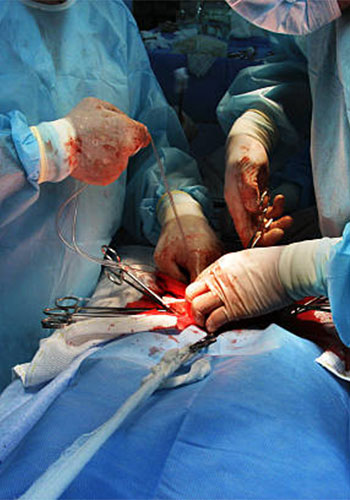 general surgery