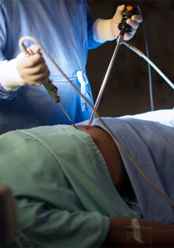 Advanced Laparoscopic Surgery